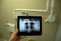 /album/fotogaleria-radiologia/rx-dig-jpg/